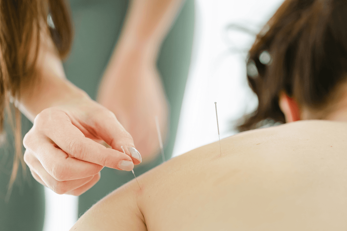Image for 45 min Massage Therapy (Acupuncture)